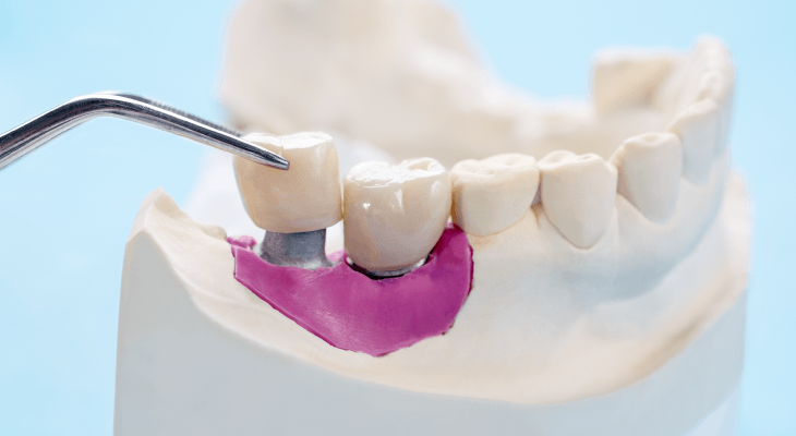 AIMST Dentist Reveals-Dental technologists are crucial