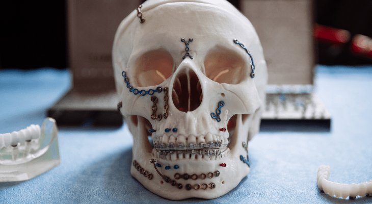 AIMST Dentist Reveals-Not limited to teeth and gums