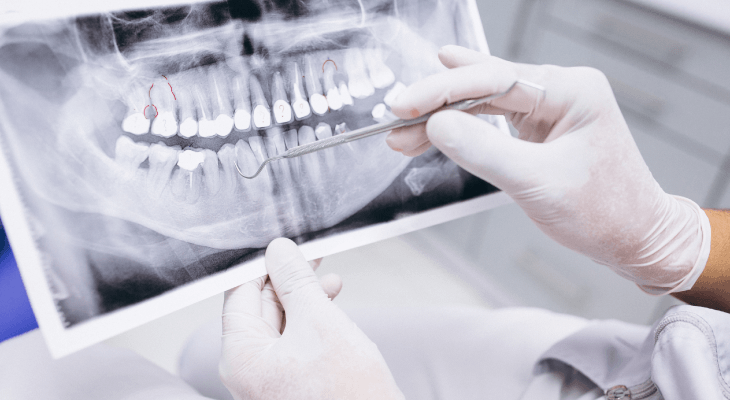 Dentist Myths-Only deal with teeth