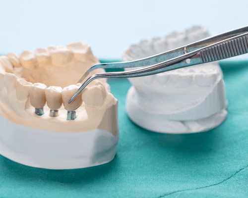 8 Types of Dental Specialists and What They Do